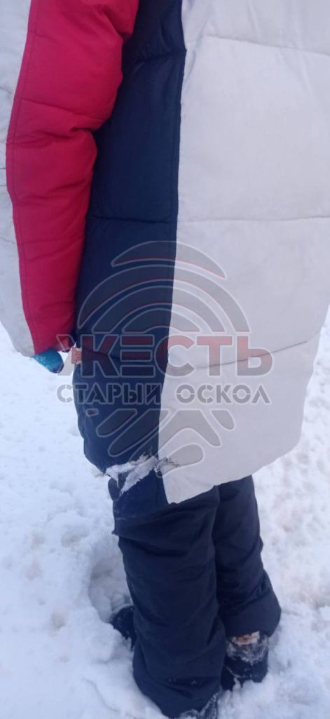 Следственный комитет взял на контроль дело о нападении бродячих собак на ребёнка в Старом Осколе